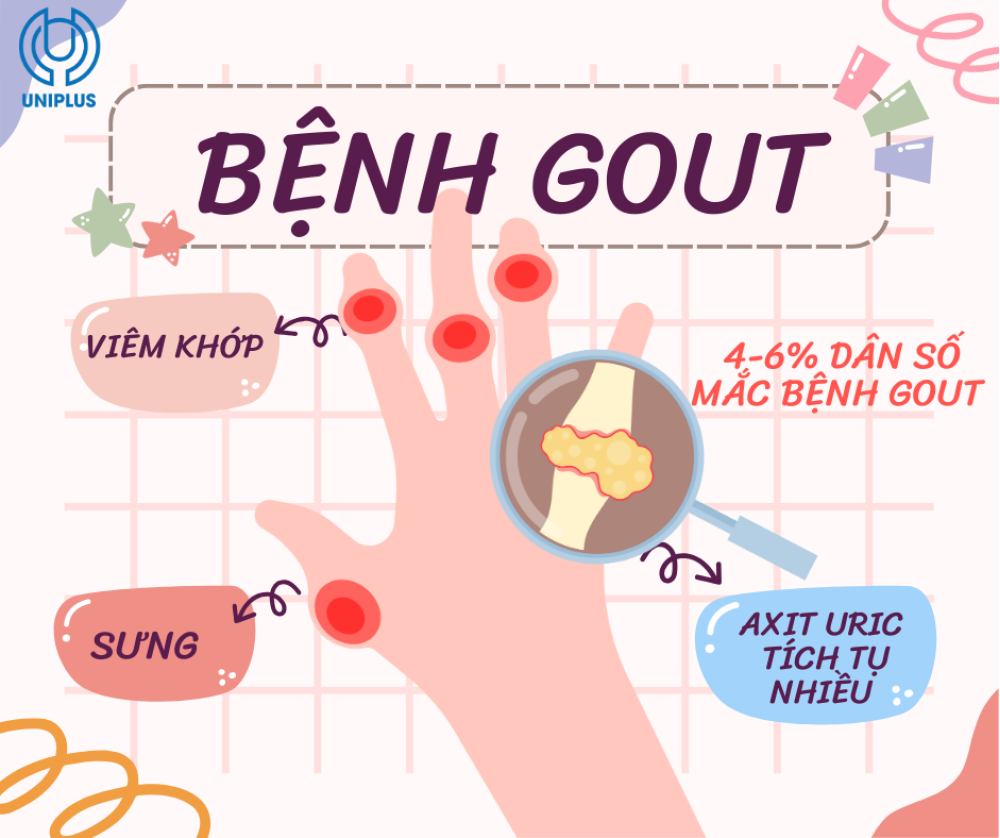Bệnh Gout: Hoàng Đế Của Các Bệnh Khớp – Hiểu Đúng Để Điều Trị Hiệu Quả