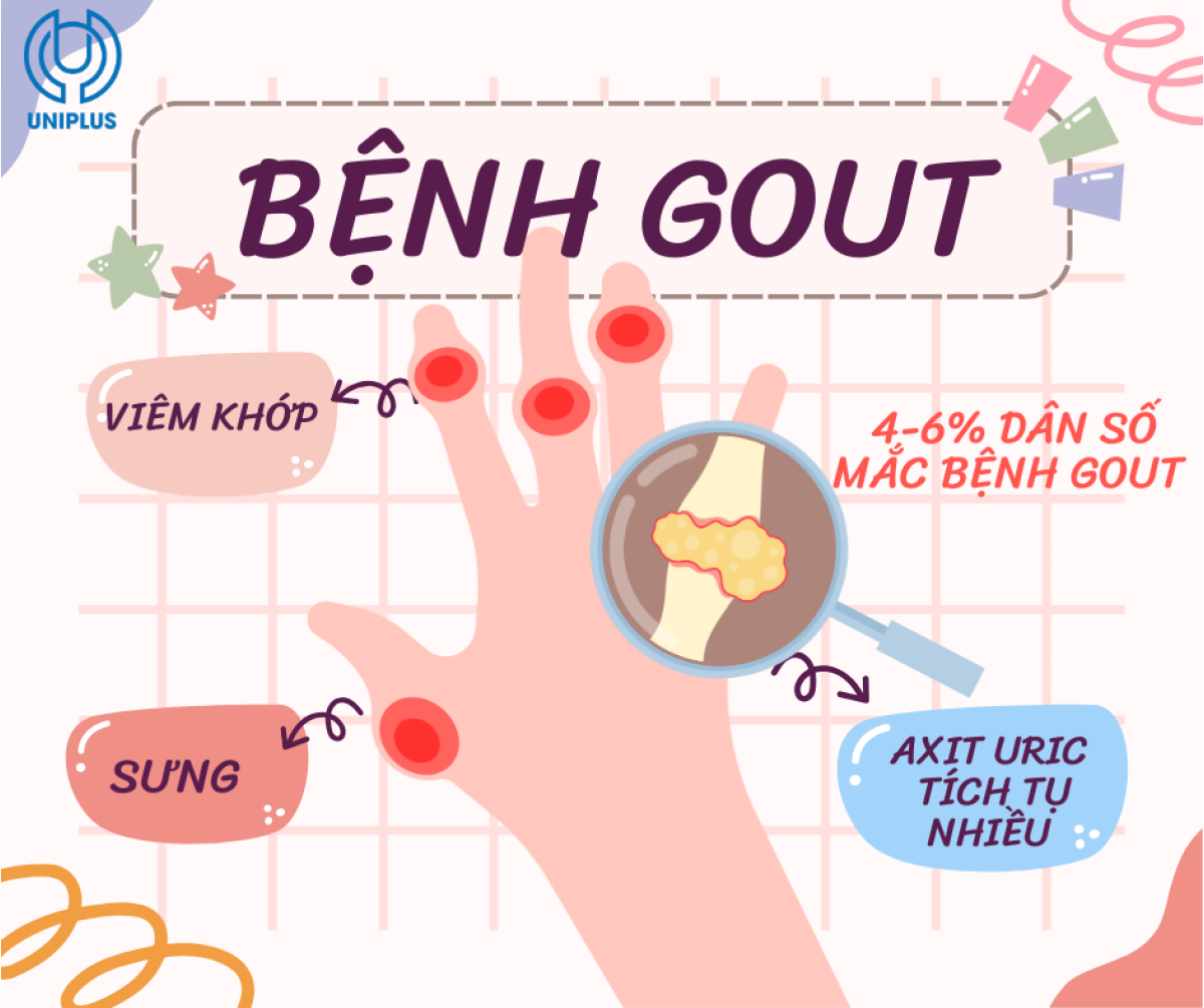 Bệnh Gout: Hoàng Đế Của Các Bệnh Khớp – Hiểu Đúng Để Điều Trị Hiệu Quả