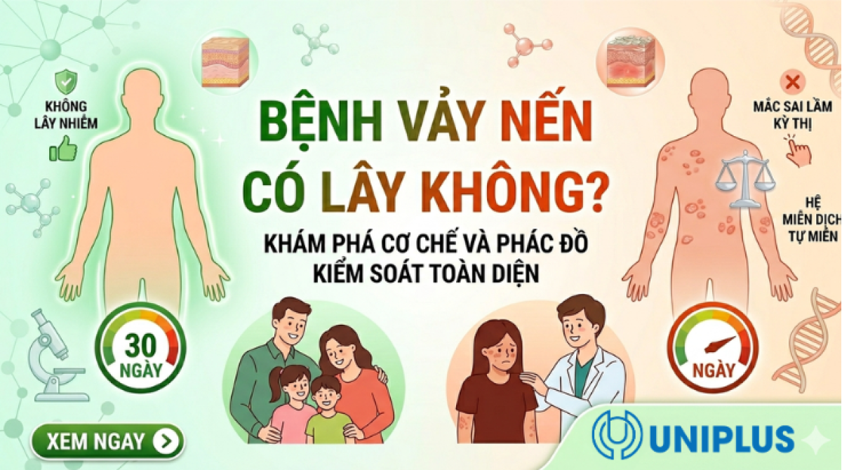BỆNH VẢY NẾN CÓ LÂY KHÔNG? NGUYÊN NHÂN, DẤU HIỆU VÀ CÁCH KIỂM SOÁT TẠI NHÀ