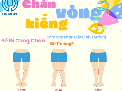Chân Vòng Kiềng Ở Trẻ Không Còn Là Nỗi Lo – Cách Điều Chỉnh An Toàn Ngay Từ Nhỏ