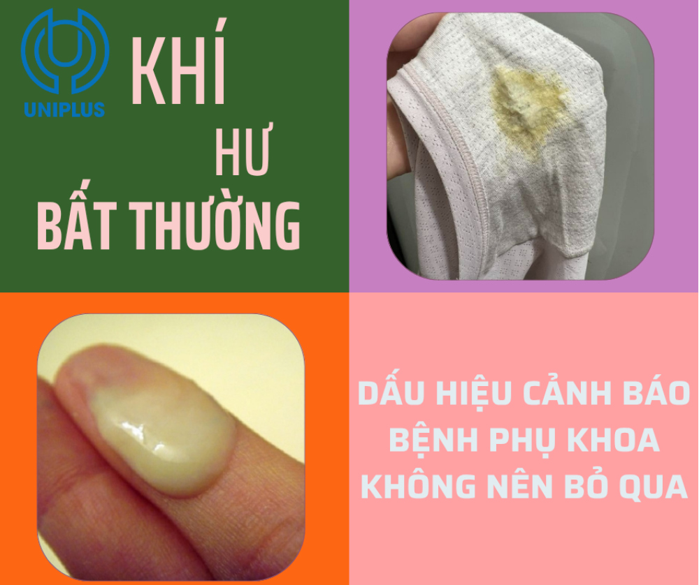 Khí hư bất thường, đừng xem nhẹ 