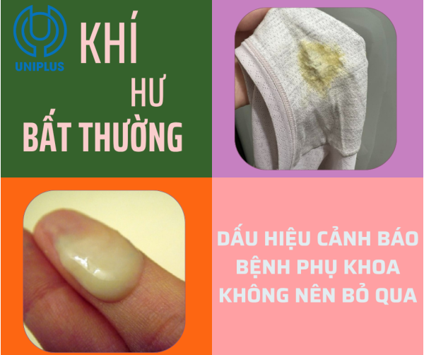 Khí hư bất thường, đừng xem nhẹ 