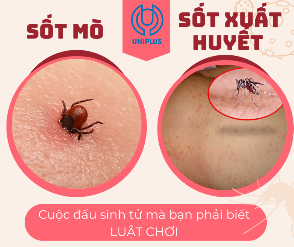 Nhầm lẫn nguy hiểm: Phân biệt sốt mò và sốt xuất huyết để điều trị đúng