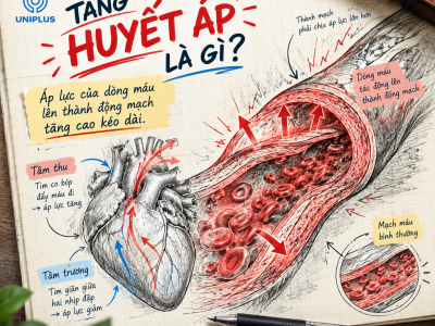 Tăng huyết áp: Đừng chờ đau đầu mới kiểm tra huyết áp