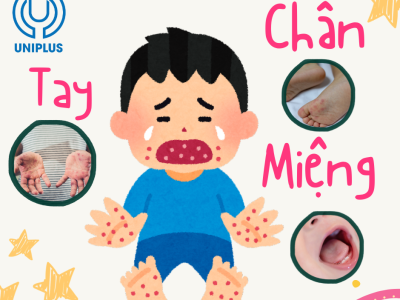Bệnh Tay Chân Miệng - Hiểu đúng để bảo vệ con yêu 