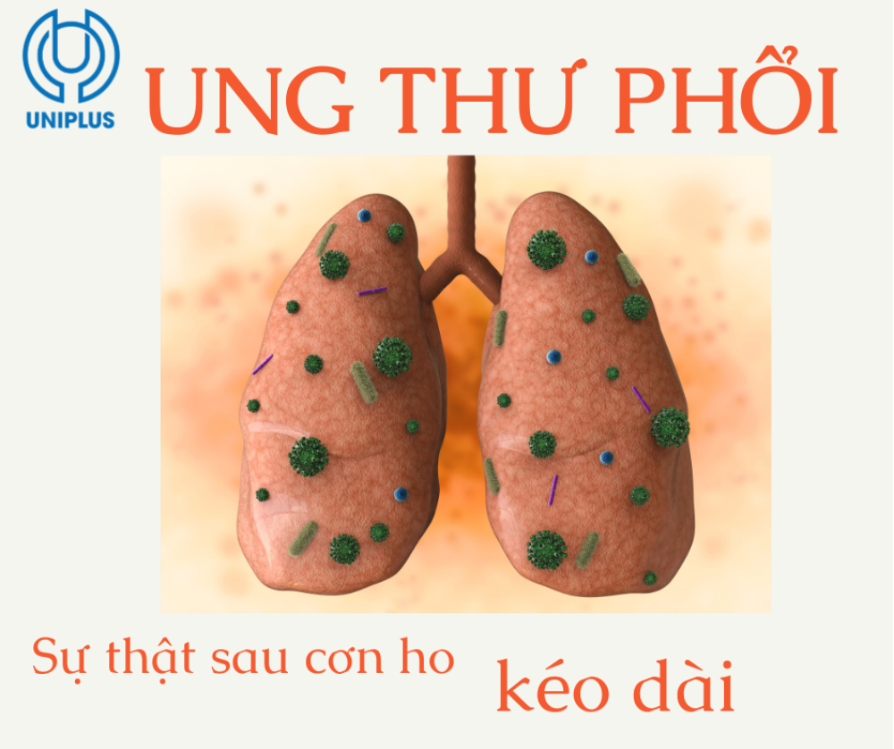 Ung thư phổi, sự thật đằng sau những cơn ho kéo dài 