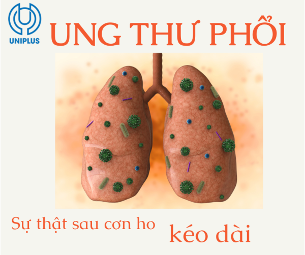 Ung thư phổi, sự thật đằng sau những cơn ho kéo dài 