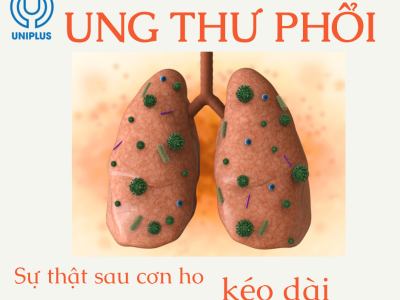 Ung thư phổi, sự thật đằng sau những cơn ho kéo dài 