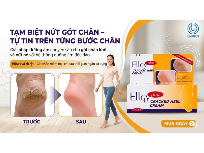 Thuốc bôi ngoài da Ellgy Plus 25g