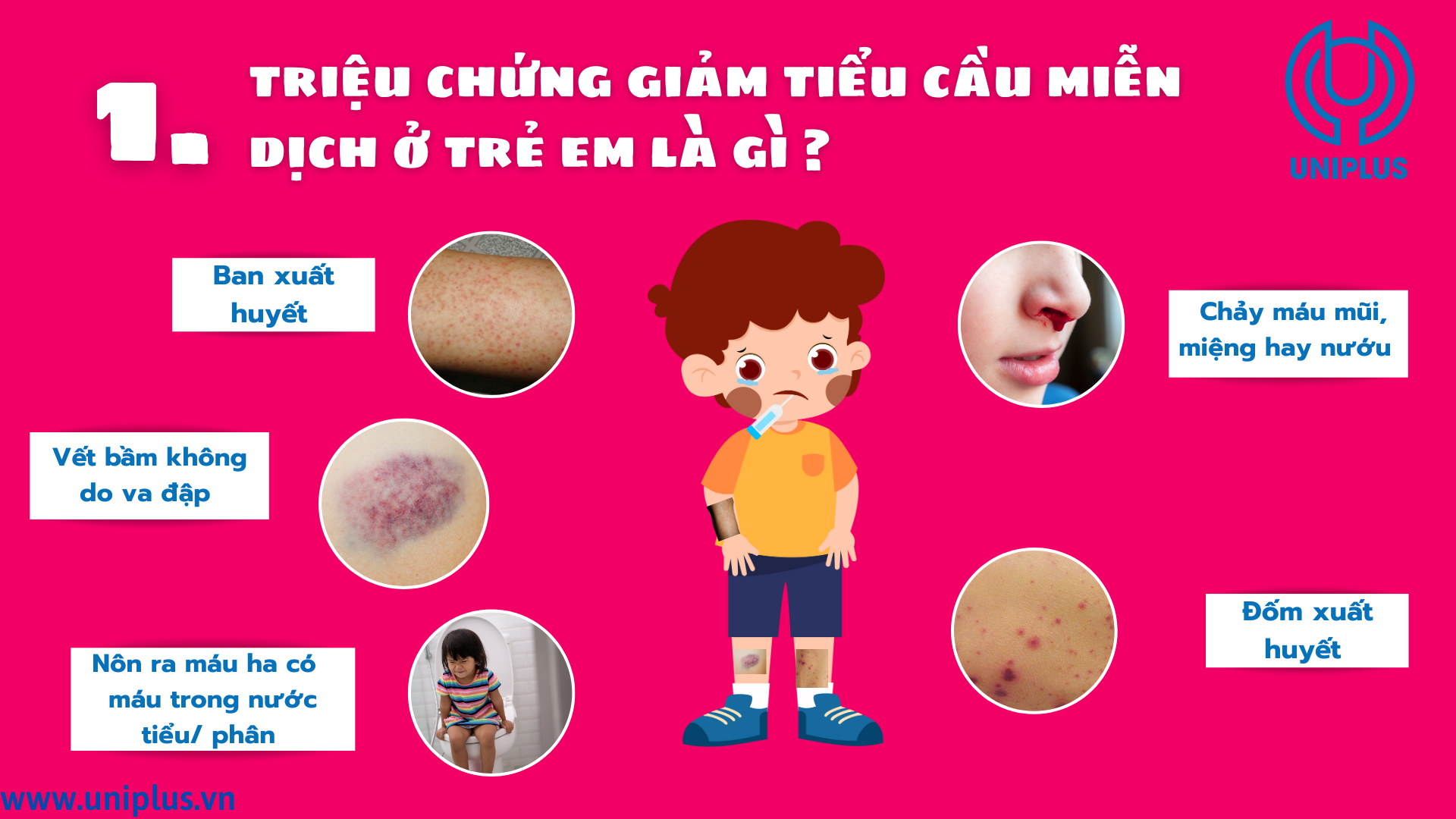 Giảm Tiểu Cầu Miễn Dịch là gì? Tìm Hiểu Nguyên Nhân, Triệu Chứng và Cách Điều Trị